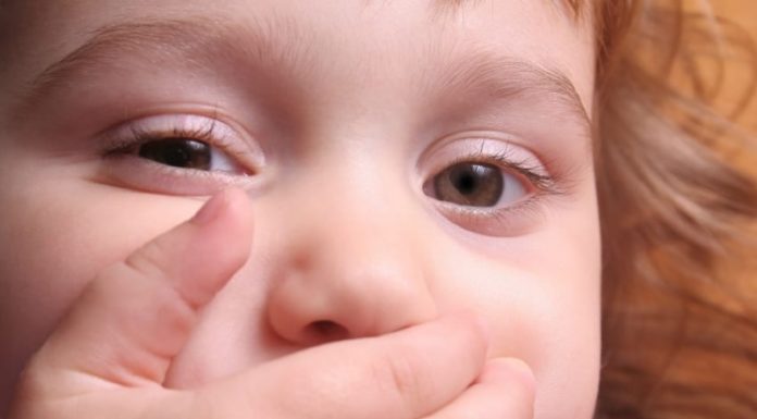 Вирусный герпес у ребенка на лице