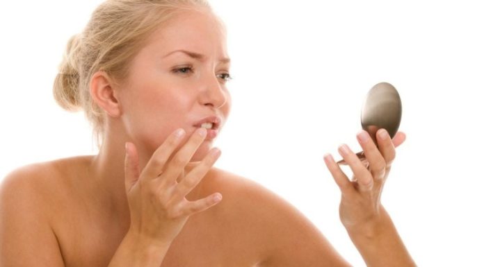 Хронический герпес