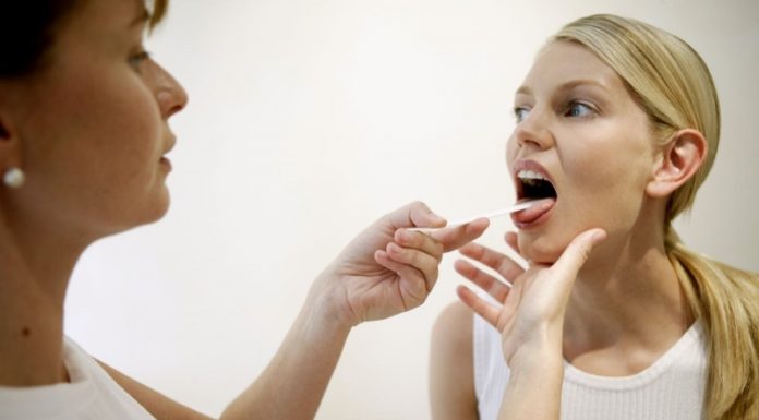 Герпесная ангина