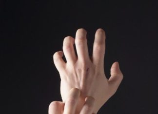 Почему чешутся бородавки?