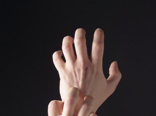 Почему чешутся бородавки?