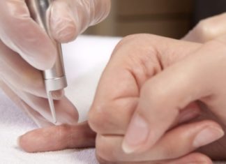 Лечение папилломавируса: профессиональные методы