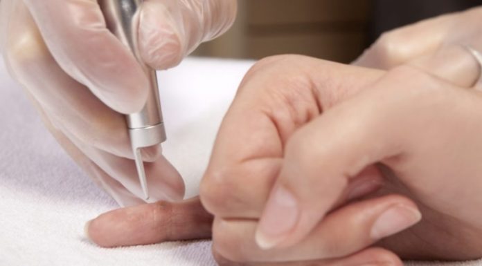 Лечение папилломавируса: профессиональные методы