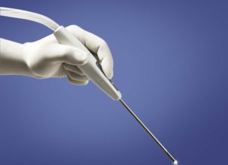 Анальные бородавки. Симптоматика и лечение