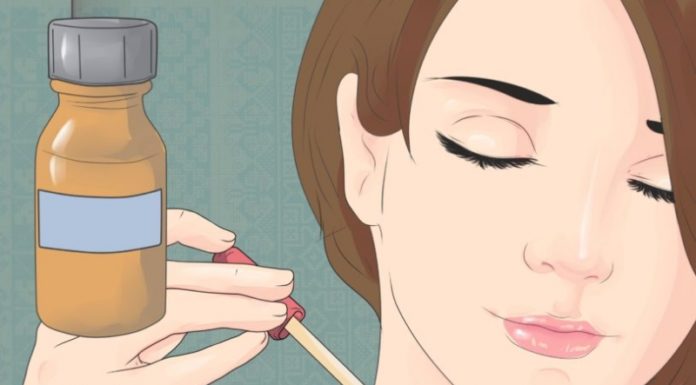 Удаление папиллом перекисью водорода