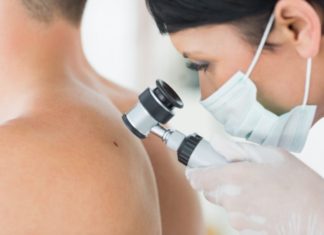 Бородавки на спине