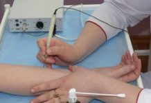 Удаление бородавок электрокоагуляцией