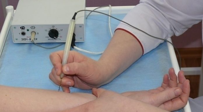 Удаление бородавок электрокоагуляцией