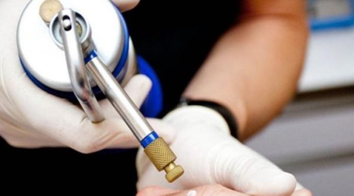 Удаление бородавок жидким азотом