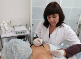 Электрокоагуляция папиллом