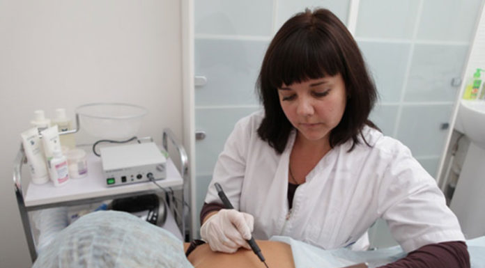 Электрокоагуляция папиллом