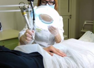 Аногенитальные бородавки