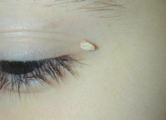 Анализ на папилломы