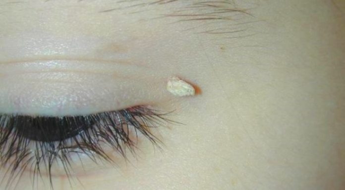 Анализ на папилломы