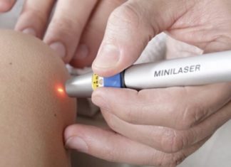 Стоимость удаления папиллом