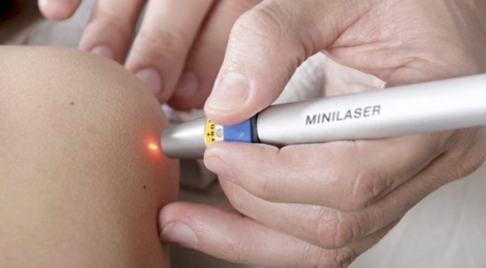 Стоимость удаления папиллом