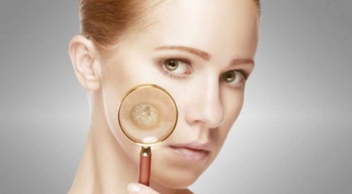 Как убрать бородавки на лице в домашних условиях