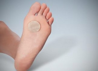 Лучшие средства от подошвенных бородавок