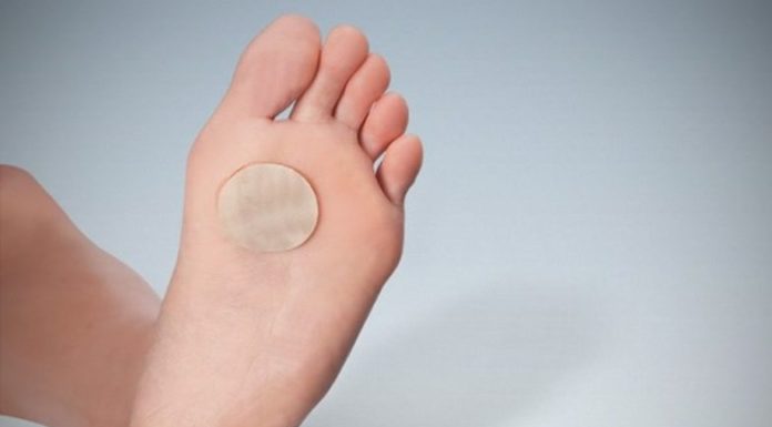 Лучшие средства от подошвенных бородавок