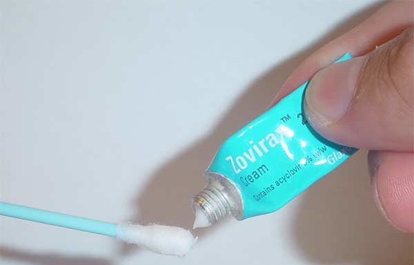 Мази для лечения генитального герпеса