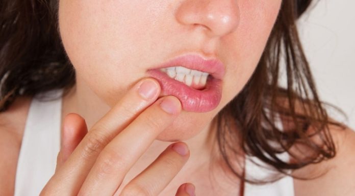 Опасен ли герпес на губах