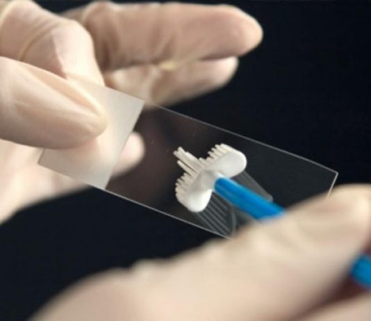 Выделения при генитальном герпесе