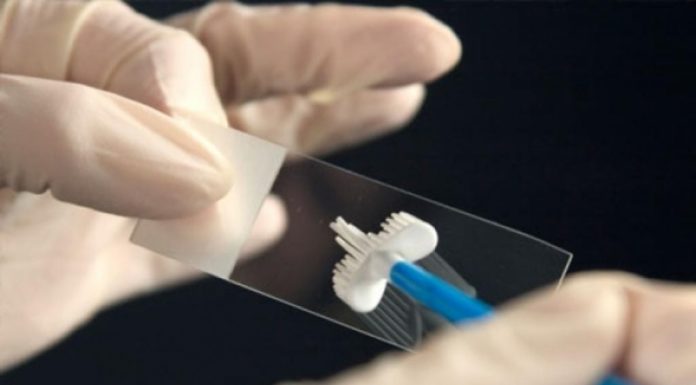 Выделения при генитальном герпесе