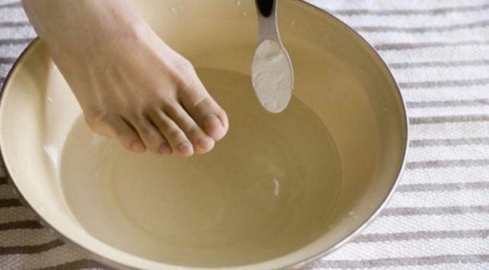 Лечение подошвенных бородавок народными средствами