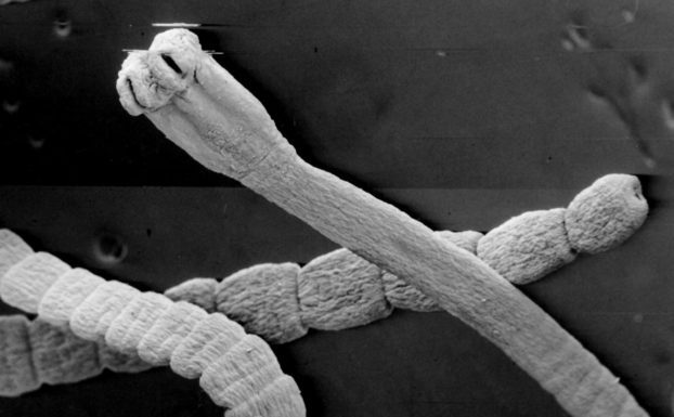 Глисты и папилломы — миф или реальность