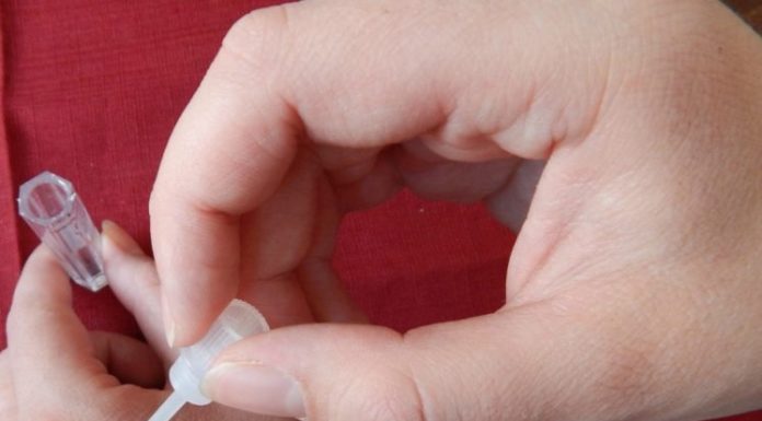 Прижигания папиллом