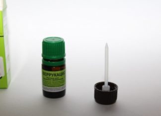 Как прижечь бородавки