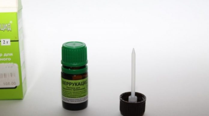 Как прижечь бородавки