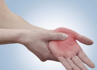 Лечение бородавки на ладонях