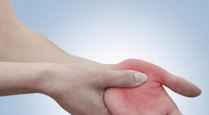 Лечение бородавки на ладонях