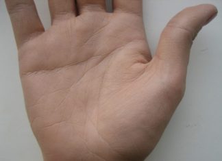 Почему бородавки могут исчезать самостоятельно