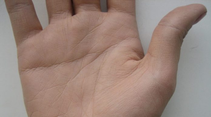 Почему бородавки могут исчезать самостоятельно