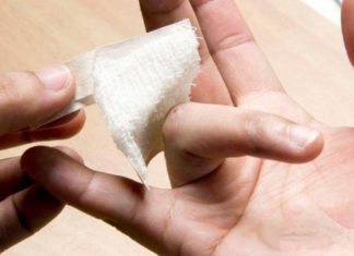 Лечим бородавки чесноком