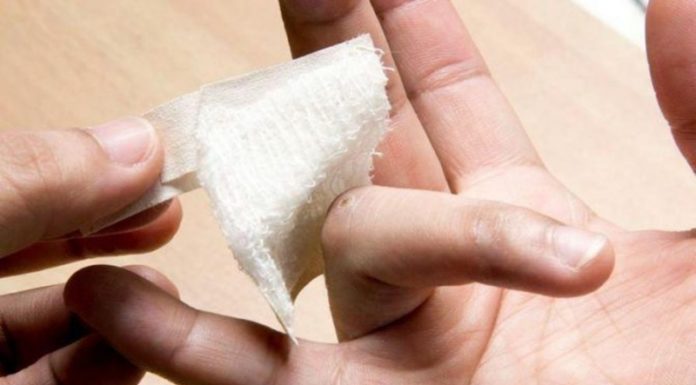 Лечим бородавки чесноком