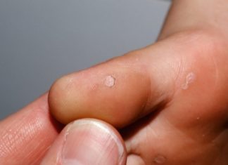 Куриная жопка: что это?