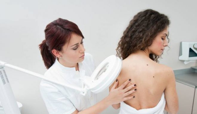 К какому врачу идти лечить папилломы